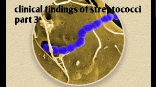 Clinical findings of streptococci  part 3 [upl. by Furgeson]