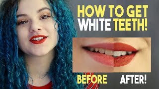 How To Get White Teeth [upl. by Ispep541]