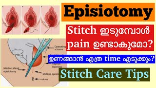 Episiotomy Malayalam│How to take care of Stitches After Normal Delivery│When to consult a Doctor [upl. by Josephina]