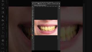 How to make teeth White in Adobe photoshopteethwhiteningphotoshoptricks short shortsfeedshorts [upl. by Hsitirb]