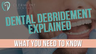 DENTAL DEBRIDEMENT EXPLAINED What You Need to Know Debridement dentist clermontdental [upl. by Kirstyn]