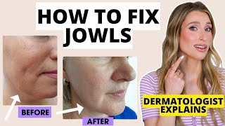 How to Fix Jowls Dermatologist Explains How to Prevent amp Get Rid of Jowls  Dr Sam Ellis [upl. by Daloris138]