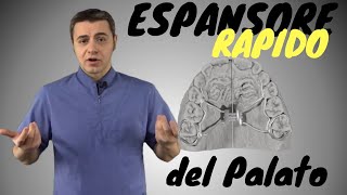 Espansore Rapido del Palato [upl. by Nirol]