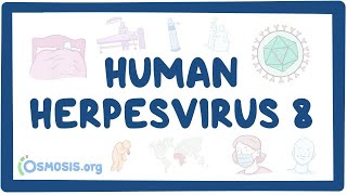 Human herpesvirus 8 Kaposis sarcoma  an Osmosis Preview [upl. by Lugar]