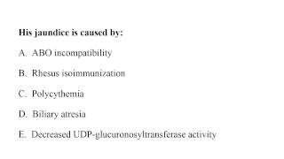 Neonatology MCQ 121 jaundice [upl. by Eldoree462]