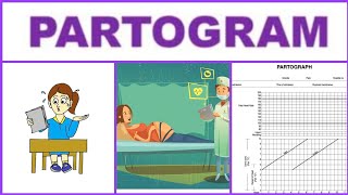 Obstetrics  Partogram  UQs [upl. by Ohcamac]