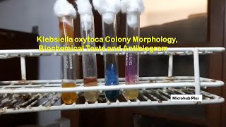 Klebsiella oxytoca colony morphology and Biochemical Tests [upl. by Melamed254]