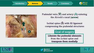 22832 Laparoscopic transperitoneal pudendal nerve and artery release for pudendal entrapment sy [upl. by Heyward]