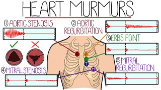 Learn Heart Murmurs In 10 Minutes With Heart Murmur Sounds [upl. by Ayortal]