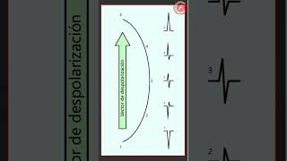 ECG 2  Vector de despolarización [upl. by Dewhirst]