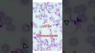 Trypanosoma [upl. by Sitruk761]