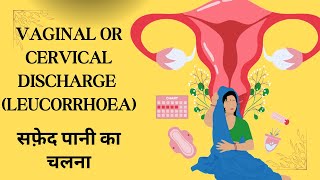 ALL ABOUT CERVICITIS सफ़ेद पानी आने की समस्या [upl. by Oilegor228]