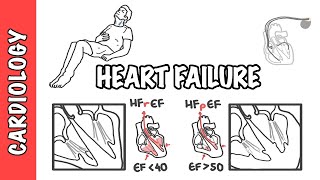 Heart failure with reduced and preserved ejection fraction pathophysiology and treatment [upl. by Fisken]