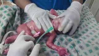 New born baby preterm 32 weeker baby is week and low birth weight but baby is alive removing vernix💞 [upl. by Willcox8]