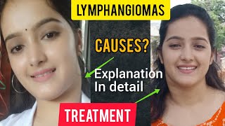 LYMPHANGIOMAexplanation in detailhow I treated it👍 CAUSES TYPES AND SYMPTOMS [upl. by Thorncombe681]