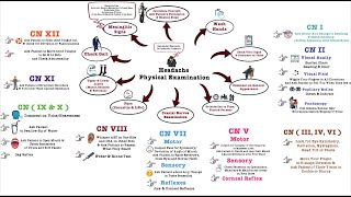 Headache Physical Examination  OSCE [upl. by Netta]