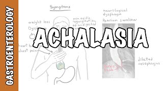 Achalasia esophageal  signs and symptoms pathophysiology investigations and treatment [upl. by Leimad674]