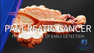 Pancreatic Cancer The Importance of Early Detection [upl. by Brittne646]