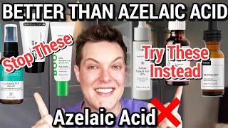 The BIG AZELAIC ACID MYTH  You Need To Try This Instead [upl. by Essy978]