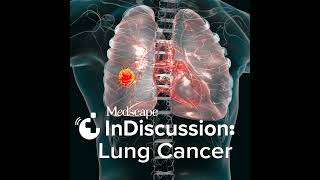 S1 Episode 4 Managing Lung Cancer With Neoadjuvant and Adjuvant Therapy [upl. by Barcus]