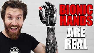 This Bionic Hand Will Change Everything [upl. by Leland]