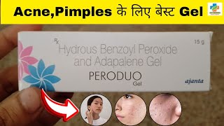 Peroduo Gel Use in Hindi  Benzoyl peroxide amp Adapalene Gel Use  Acne  pimples  SK MEDICINE [upl. by Maryrose]