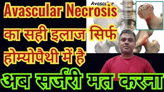 How can we manage Avascular Necrosis with Homeopathic medicines without surgery [upl. by Ballou651]