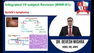 🕉 Integrated 19 subject Revision INR81 Burkitts lymphoma by Dr Devesh Mishra [upl. by Ramberg696]