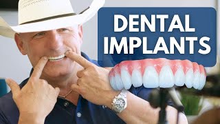 Why No One Tells You The Cost Of Dental Implants [upl. by Ajar519]