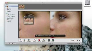 How to remove blemishes from photos using iphoto [upl. by Voccola]