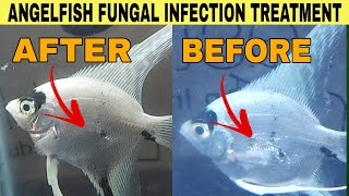 Angelfish Fungal Infection Treatment  How to Treat Fungal Infection  Sick Angelfish Treatment [upl. by Inalaek]