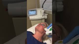 Rosacea Treatment with IPL [upl. by Udell787]