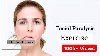 Exercise In Facial Paralysis फेस की एक्सरसाइज [upl. by Mattah]