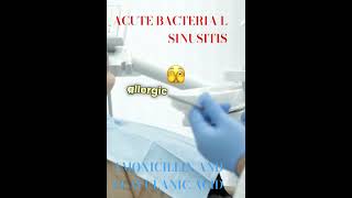 ACUTE BACTERIAL SINUSITIS [upl. by Bate262]