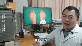 hallux valgus 青少年拇外翻怎么办？大陆哪里做拇趾外翻 [upl. by Aniad]