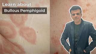 Breaking Down Bullous Pemphigoid Symptoms Causes and Solutions  Pathology Navigatorpathology [upl. by Najram]