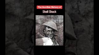 The Shocking History of “Shell Shock” [upl. by Ennire925]