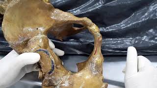 Clase de pelvis anatomía parte 1 281119 HD 1080p [upl. by Dardani]