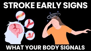 7 Warning Signs of a Stroke What Your Body Signals a Month Early [upl. by Chavey]