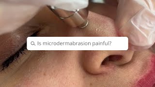 Is Microdermabrasion painful  Results Laser Clinic [upl. by Pamella]