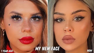 I got a new face WITHOUT surgery and you can too [upl. by Allisan]