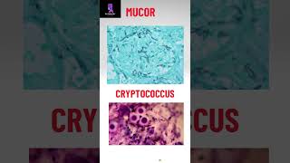 Morphology of some pathogenic fungi pathologyacademy mbbs draditikumar labtechnician [upl. by Kriss115]