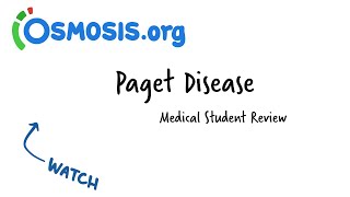 Paget Disease Osmosis Study Video [upl. by Gimble875]