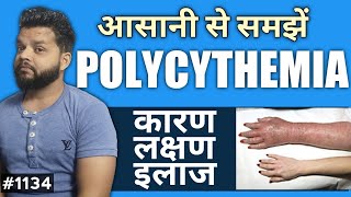 Polycythemia In Hindi  Polycythemia Causes Symptoms amp Treatment [upl. by Eniad]