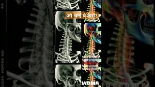 ओ भाई ये कैसेskeletalsystem humanrights [upl. by Doownil]