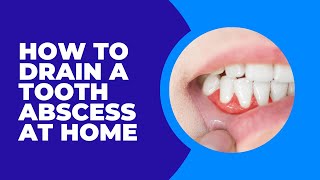 Should you Drain a Tooth Abscess at Home [upl. by Eran682]