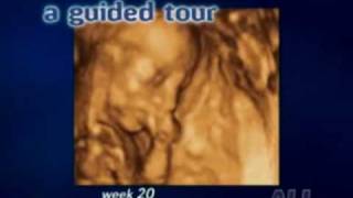 Echographie vidéo 3D du foetus [upl. by Wera]