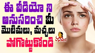 Tips To Get Clear Glowing Spotless Skin II Beauty Tips  Face pack For Glowing Skin  Vanitha TV [upl. by Sosanna]