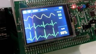 IoT a Small heart ECG tester amp Oximeter [upl. by Artek]