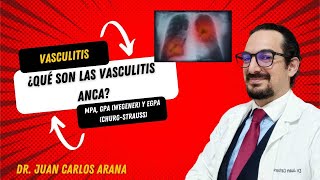 Vasculitis asociadas a ANCA [upl. by Mast]